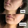 Vlažilna esenca za sijočo polt 100 ml