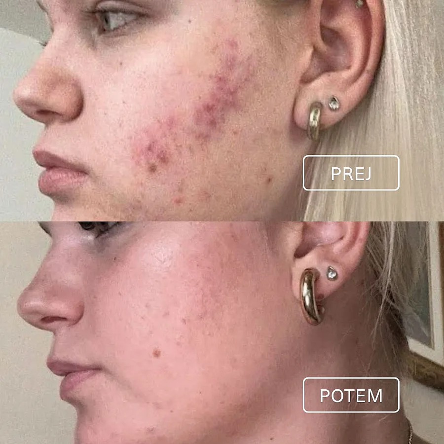 Čistilni gel za obraz 100 ml