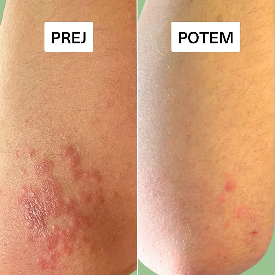 Terapevtsko CBD mazilo za kožo 50 ml